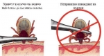 ДДД услуги – сигурна защита от вредители